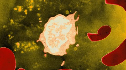 Plasmodium (yellow) infecting blood cells