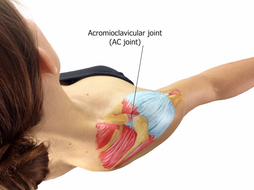 The shoulder joint may suffer dislocation