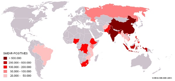 Map of Tuberculosis in the World