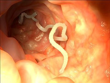Photo of a tapeworm in the human intestine.
