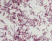 Aerobic gram-positive bacillus
