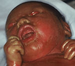At birth, the newborn is covered by a shiny, transparent and tight membrane reminiscent of a cellophane wrap.